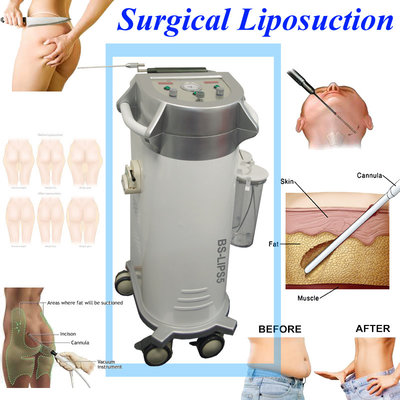 China Low Noise Body Shaped Power Assisted Liposuction Equipment For Hospital supplier