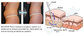electric liposuction resonance ancillary device for plastic surgery aspirator machine supplier