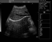 Full digital B/W ultrasound system EW-B22V for Veterinary diagnostic