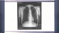 Veterinary LED x-ray illuminator,film viewer box,negatoscope MST-4000II double panel