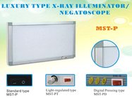 Veterinary Medical x-ray illuminator,film viewer box,negatoscope MST-P standard double union