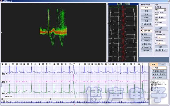 China Holter ECG Software 3/12 Channels 24-Hours Ambulatory ECG Holter Monitor HRT, T-wave alterans &amp; HRV supplier