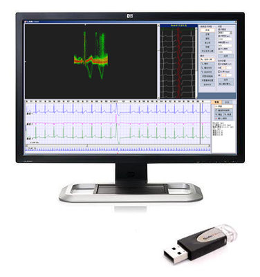 China 3/12 Channels 24 Hour Holter ECG Workstation Holter Recorder Analysis Software supplier