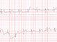 Mobile ECG Monitor Case Single Lead Bluetooth Cardiac Check Recorder ECG Monitor supplier