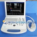 15inch monitor portable ultrasound scanner digital color doppler medical equipment