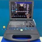 Economic type portable color doppler 15" monitor portable ultrasound scanner