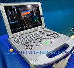 15 inch monitor Diagnosis Equipment Digital Portable Ultrasound