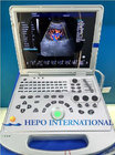 portable CW function 3D ultrasound scanner for cardiac for hospital