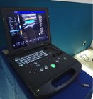Portable 3D Color Doppler Hospital Product portable ultrasonic