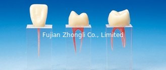 China Hot Sale Dental Root Canal Crown Treatment S3 supplier