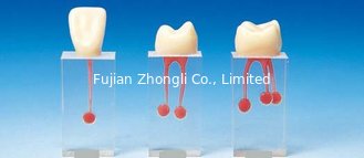 China Cheap Root Canal Filling S6 supplier
