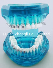 China Dental Correction Model Bracket Contrast Model Metal Brackets Ceramic Brackets supplier