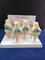 4-Stage Osteo-Arthritic Knee Anatomical Model Anatomical Model supplier
