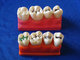 Dental Four times the pit and fissure model supplier