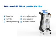 Fractional RF microneedle machine face lifting rf skin rejuvenation beauty equipment