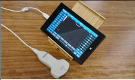 New arrival USB Ultrasound machine / USB ultrasound probe for laptop / USB ultrasound transducer