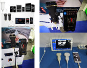electric linear digital USB portable /handheld ultrasound machine/system/probe from manufacturer