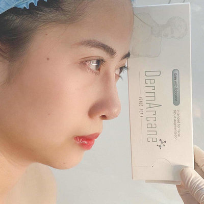 China Hyaluronic Acid Injection dermal fillers lip filler Breast Buttock Enhancement Anti Aging Dermal Filler supplier