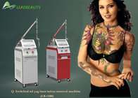 Professional 2000W power q switch nd yag laser tattoo removal machine with a good quality