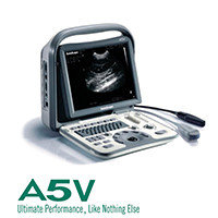 China Portable veterinary Sonoscape Ultrasound supplier