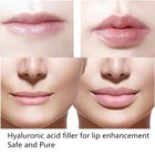 Sexy Lips Injection of Hyaluronic Acid Gel 2ml of Derm Deep Kind