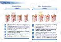 Multifunction beauty machine opt shr ipl laser spectrum for hair removal