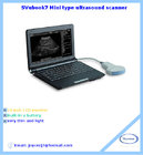 Full Digital Laptop VET Ultrasound Scanner with CE and ISO Approved Manufacturer