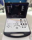 Ultrasound System 3D Portable Color Doppler Ultrasound Machine (YJ-U80PLUS)