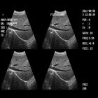 Portable Diagnosis System fetal heart rate Ultrasound Echo Doppler Ultrasound Price B/W USG Scanner system