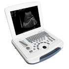 Laptop Ultrasoundgraph (USG) Ultrasound Diagnostic System  B-Ultrasound Diagnostic System