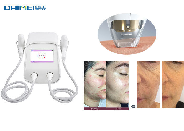 Tixel Mezotix Skin Rejuvenation Technology Novoxel Stretch Marks Scars Removal supplier