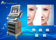 Newest 2016 hifu face lifting high intensity focused ultrasound skin tightening machine