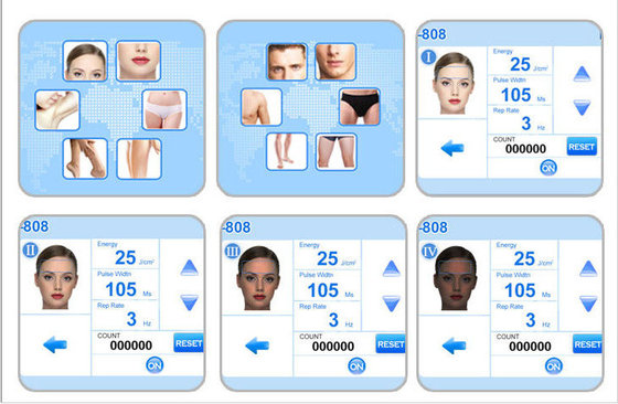 Newest design from Sanhe /professional 808nm Diode Laser hair removal equipment